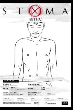 Stoma